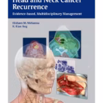 Head and Neck Cancer Recurrence - Evidence-Based Guide