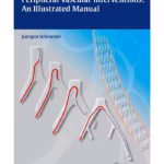 Peripheral Vascular Interventions An Illustrated M