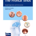 The Frontal Sinus: Surgical Approaches and Controversies - 1st Edition Clinical Guide