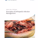 Principles of Orthopedic Infection Management - 1st Edition