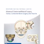 Advanced Craniomaxillofacial Surgery: Tumor, Corrective Bone Surgery, and Trauma - 1st Edition Medical Textbook