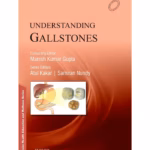 Understanding Gallistones - 1st Edition