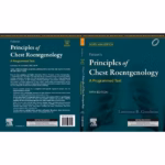 Felsons Principles of Chest Roentgenology, A Programmed Text - 5th Edition