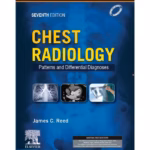 Chest Radiology: Patterns and Differential Diagnoses - 7th Edition Clinical Guide