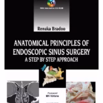 Anatomical Principles of Endoscopic Sinus Surgery: A Step-by-Step Approach with Interactive CD-ROM - Clinical Guide
