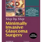 Step by Step Minimally Invasive Glaucoma Surgery with DVD-ROM - Clinical Guide