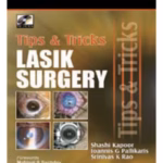 Tips and Tricks in LASIK Surgery with DVD-ROM - Clinical Guide