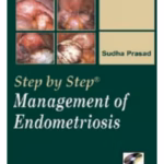 Step-by-Step Management of Endometriosis with DVD-ROM - Medical Textbook