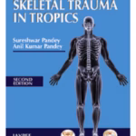 Skeletal Trauma In Tropics