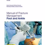 AO Trauma Manual of Fracture Management: Foot and Ankle - 1st Edition (Indian Reprint) Clinical Guide