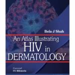 Atlas Illustrating HIV in Dermatology - Medical Textbook