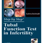 Step-by-Step Tubal Function Test in Infertility with DVD-ROM - Clinical Guide