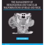 The Management Of Hemangiomas And Vascular Malformations Of Head And Neck