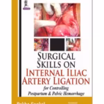 Surgical Skills in Internal Iliac Artery Ligation: Controlling Postpartum and Pelvic Hemorrhage - Clinical Guide