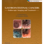 Gastrointestinal Cancers: Endoscopic Imaging and Treatment with DVD-ROMs - Medical Textbook