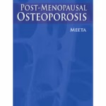 Postmenopausal Osteoporosis: Basic and Clinical Concepts - Clinical Guide