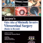 Jaypee Video Atlas Of Minimally Invasive Vitreoretinal Surgery