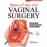 State-of-the-Art Vaginal Surgery with 2 Interactive DVD-ROMs - Clinical Guide