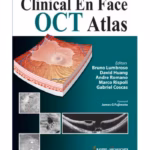 Clinical En Face Oct Atlas