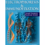 Electrophoresis & Immunofixation