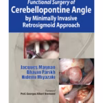 Functional Surgery Of Cerebellopontine Angle By Minimally Invasive Retrosigmoid Approach