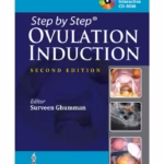 Step-by-Step Ovulation Induction with CD-ROM - Medical Textbook