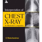 Interpretation Of Chest X-Ray An Illustrated Companion