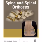 Spine And Spinal Orthoses