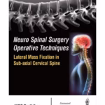 Neuro Spinal Surgery Operative Techniques:Lateral Mass Fixation In Sub-Axial Cervical Spine