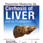 Preventive Measures for Cirrhosis of the Liver and Its Progression - Clinical Guide