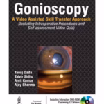 Gonioscopy:A Video Assisted Skill Transfer Approach With Dvd-Rom