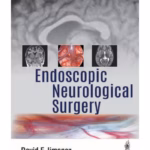 Endoscopic Neurological Surgery - Clinical Guide