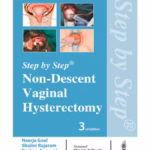 Step-by-Step Non-Descent Vaginal Hysterectomy - Medical Textbook