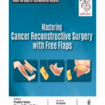 Mastering Cancer Reconstructive Surgery with Free Flaps - Clinical Guide
