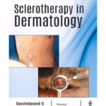Sclerotherapy In Dermatology