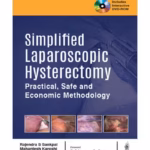 Simplified Laparoscopic Hysterectomy: Practical, Safe, and Economic Methodology with DVD-ROM