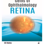 Gems Of Ophthalmology Retina