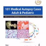 101 Medical Autopsy Cases Adult & Pediatric With Complete Pathological/ Clinical Details And Review