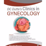 Dc Dutta’S Clinics In Gynecology