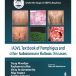 Iadvl Textbook Of Pemphigus And Other Autoimmune Bullous Diseases