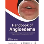 Handbook Of Angioedema
