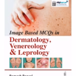 Image Based Mcq'S In Dermatology, Venereology & Leprology