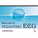 Manual Of Pediatric Eeg