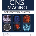 Cns Imaging For Postgraduates