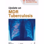 Update on MDR Tuberculosis - Clinical Guide