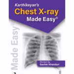 Karthikeyan'S Chest X-Ray Made Easy
