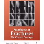 Handbook Of Fractures The Current Concepts