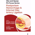 Obstetrics and Gynecology PG Focus Series: Postpartum Hemorrhage and Internal Iliac Artery Ligation - Clinical Guide