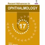 Recent Advances In Ophthalmology-17