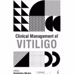 Clinical Management Of Vitiligo